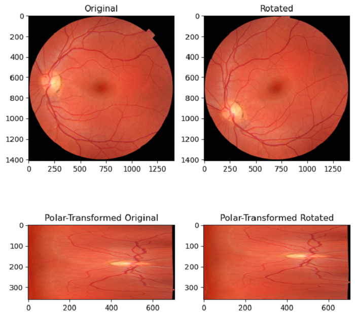registration using polar trasformation